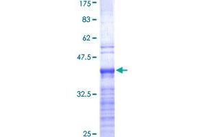 RPL19 Protein (AA 1-100) (GST tag)