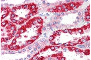 Human Kidney: Formalin-Fixed, Paraffin-Embedded (FFPE) (OCIAD2 Antikörper  (N-Term))