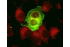 Immunofluorescence (IF) image for anti-Herpes Simplex Virus Type 1, Glycoprotein C (HSV1 gC) antibody (ABIN265557) (HSV-1 gC Antikörper)