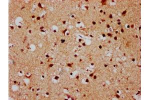 IHC image of ABIN7152883 diluted at 1:500 and staining in paraffin-embedded human brain tissue performed on a Leica BondTM system. (FSD1 Antikörper  (AA 251-370))