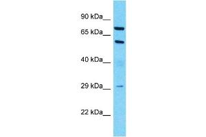 Host:  Rabbit  Target Name:  MUC13  Sample Type:  Lymph Node Tumor lysates  Antibody Dilution:  1. (MUC13 Antikörper  (C-Term))