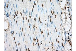 Immunohistochemical staining of paraffin-embedded liver tissue using anti-ACSBG1 mouse monoclonal antibody. (ACSBG1 Antikörper)