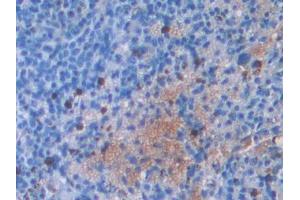 Used in DAB staining on fromalin fixed paraffin- embedded stomach tissue (IL2RG Antikörper  (AA 23-263))