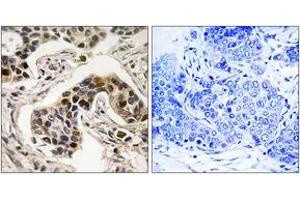 Immunohistochemistry (IHC) image for anti-NUDC (AA 282-331), (pSer326) antibody (ABIN1532162)