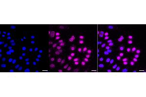 Immunocytochemical staining of HepG2 cells with Cyclin dependent kinase 1 antibody (ABIN7798206), 1:1,000).