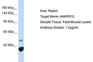 Host: Rabbit Target Name: ANKRD12 Sample Type: Fetal Muscle lysates Antibody Dilution: 1. (ANKRD12 Antikörper  (N-Term))