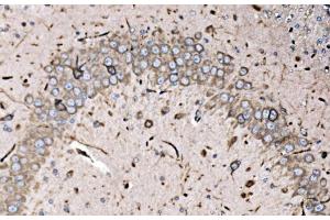 IHC analysis of FXR1 using anti-FXR1 antibody (ABIN7600093).