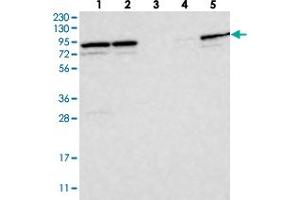 Western blot analysis of Lane 1: RT-4, Lane 2: U-251 MG, Lane 3: Human Plasma, Lane 4: Liver, Lane 5: Tonsil with PARP6 polyclonal antibody  at 1:250-1:500 dilution. (PARP6 Antikörper)