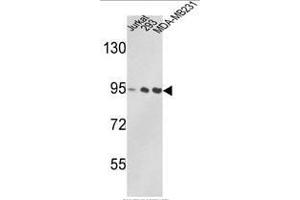 Western blot analysis of VCP Antibody (C-term) in Jurkat, 293, MDA-MB231 cell line lysates (35ug/lane). (VCP Antikörper  (C-Term))