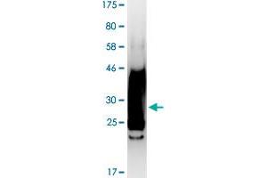 Image no. 2 for Tumor Necrosis Factor (Ligand) Superfamily, Member 8 (TNFSF8) (AA 63-234) protein (His-DYKDDDDK-Strep II Tag) (ABIN1323248) (TNFSF8 Protein (AA 63-234) (His-DYKDDDDK-Strep II Tag))