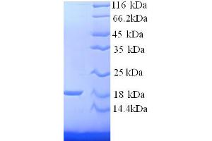 SDS-PAGE (SDS) image for Hemoglobin, beta Adult Minor Chain (HBB-B2) (AA 2-147) protein (His tag) (ABIN4974915) (Hemoglobin, beta Adult Minor Chain (HBB-B2) (AA 2-147) protein (His tag))