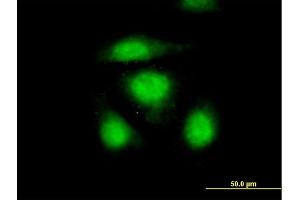 Immunofluorescence of purified MaxPab antibody to OSTF1 on HeLa cell. (OSTF1 Antikörper  (AA 1-217))
