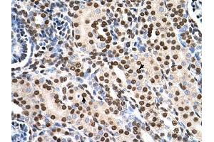 RSU1 antibody was used for immunohistochemistry at a concentration of 4-8 ug/ml to stain Epithelial cells of renal tubule (arrows) in Human Kidney.