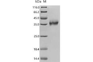 (Tris-Glycine gel) Discontinuous SDS-PAGE (reduced) with 5 % enrichment gel and 15 % separation gel.
