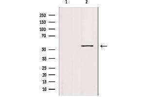 Western blot analysis of extracts from 293, using KLF11 Antibody. (KLF11 Antikörper  (N-Term))