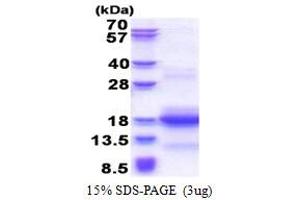 SDS-PAGE (SDS) image for Canopy 1 Homolog (CNPY1) (AA 1-92) protein (His tag) (ABIN5853553)