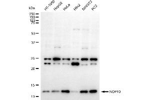 anti-NOP10 Ribonucleoprotein Homolog (Nop10) antibody
