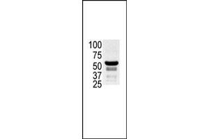 The anti-K2 b (ABIN392433 and ABIN2842033) is used in Western blot to detect K2 in ovary cell lysate. (PAK2 Antikörper  (N-Term))