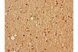 Immunohistochemistry of paraffin-embedded human brain tissue using ABIN7168669 at dilution of 1:100 (SCGN Antikörper  (AA 1-276))