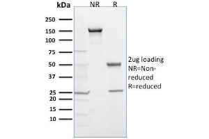 SDS-PAGE Analysis Purified EGLN1 / PHD2 Mouse Monoclonal Antibody (366G/76/3).