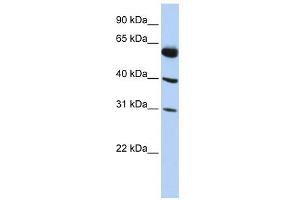LYSMD4 antibody used at 1 ug/ml to detect target protein. (LYSMD4 Antikörper  (N-Term))