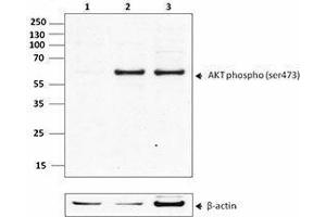 Western Blotting (WB) image for anti-V-Akt Murine Thymoma Viral Oncogene Homolog 1 (AKT1) (phosphorylated) antibody (ABIN2666091) (AKT1 Antikörper  (phosphorylated))
