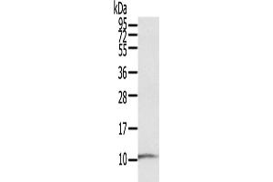 Western Blotting (WB) image for anti-S100 Calcium Binding Protein P (S100P) antibody (ABIN5544743) (S100P Antikörper)