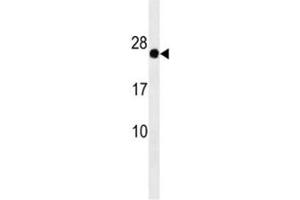 GAGE12F antibody western blot analysis in HepG2 lysate (G Antigen 12F Antikörper  (AA 1-30))