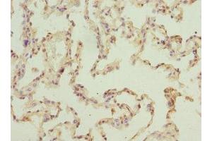 Immunohistochemistry of paraffin-embedded human lung tissue using ABIN7151524 at dilution of 1:100 (ELMOD1 Antikörper  (AA 185-334))
