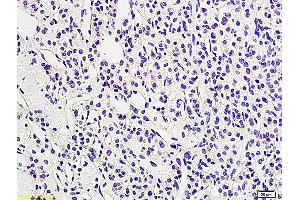 Formalin-fixed and paraffin embedded human adrenal tissue labeled with Anti LHR/CGR Polyclonal Antibody, Unconjugated (ABIN873328) followed by conjugation to the secondary antibody and DAB staining