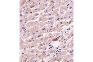 C staining G7L in human liver tissue sections by Immunohistochemistry (IHC-P - paraformaldehyde-fixed, paraffin-embedded sections). (ATG7 Antikörper  (AA 494-523))