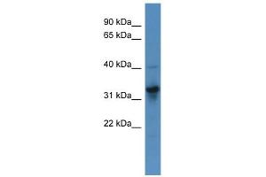 WB Suggested Anti-T Antibody Titration:  0. (T Brachyury Protein (N-Term) Antikörper)