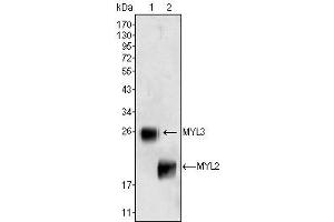 Western Blot showing MYL3 (1) and MYL2 (2) antibody used against rat fetal heart tissues lysate. (MYL3/CMLC1 Antikörper)