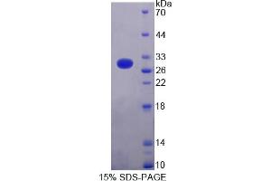 Image no. 1 for Cardiac Troponin I (TNNI3) (AA 2-211) protein (His tag) (ABIN4988436)