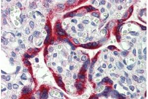 Placenta, Human: Formalin-Fixed, Paraffin-Embedded (FFPE) (MKNK2 Antikörper  (AA 36-85))