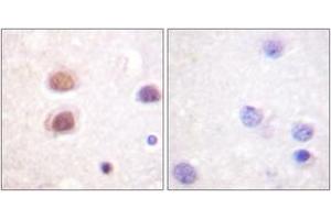 Immunohistochemistry analysis of paraffin-embedded human brain, using p38 MAPK (Phospho-Tyr322) Antibody. (MAPK14 Antikörper  (pTyr322))