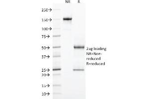 SDS-PAGE (SDS) image for anti-Integrin, alpha E (Antigen CD103, Human Mucosal Lymphocyte Antigen 1, alpha Polypeptide) (ITGAE) antibody (ABIN6939807)