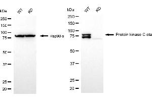 Western blotting analysis using protein kinase C eta antibody (ABIN7799997). (Rekombinanter PKC eta Antikörper)