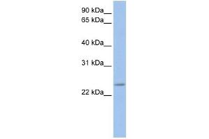 WB Suggested Anti-FKBP3 Antibody Titration: 0. (FKBP3 Antikörper  (C-Term))