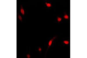 Immunofluorescent analysis of NF-kappaB p65 staining in MCF7 cells. (NF-kB p65 Antikörper  (Center))