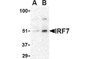 Image no. 1 for anti-Interferon Regulatory Factor 7 (IRF7) (Middle Region) antibody (ABIN265130) (IRF7 Antikörper  (Middle Region))