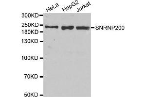 Western Blotting (WB) image for anti-Small Nuclear Ribonucleoprotein 200kDa (U5) (SNRNP200) antibody (ABIN1877090) (SNRNP200 Antikörper)