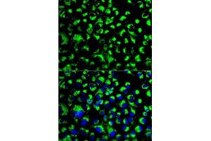 Immunofluorescence (IF) image for anti-Heat Shock 70kDa Protein 9 (Mortalin) (HSPA9) (AA 380-679) antibody (ABIN3021000)