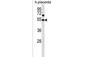 SNX30 Antibody (C-term) (ABIN1537180 and ABIN2849996) western blot analysis in human placenta tissue lysates (35 μg/lane). (SNX30 Antikörper  (C-Term))