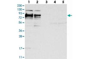 Western blot analysis of Lane 1: RT-4, Lane 2: U-251 MG, Lane 3: Human Plasma, Lane 4: Liver, Lane 5: Tonsil with HS6ST2 polyclonal antibody  at 1:250-1:500 dilution. (HS6ST2 Antikörper)