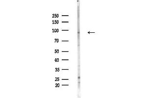 anti-RNA Binding Motif Protein 5 (RBM5) (N-Term) antibody