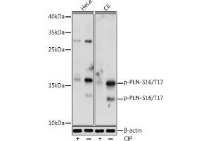 Western blot analysis of extracts of various cell lines, using Phospho-PLN-S16/T17 antibody (ABIN7269330) at 1:1000 dilution. (Phospholamban Antikörper  (pSer16, pThr17))