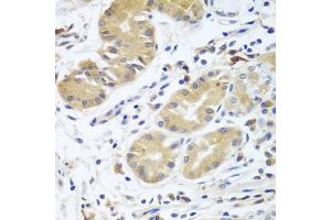 Immunohistochemistry of paraffin-embedded human stomach using CFD antibody (ABIN5974492) at dilution of 1/100 (40x lens). (Adipsin Antikörper)
