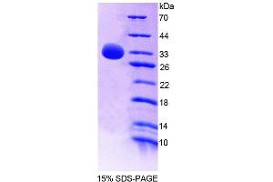 SDS-PAGE (SDS) image for Protein tyrosine Phosphatase, Non-Receptor Type 7 (PTPN7) (AA 52-314) protein (His tag) (ABIN4989868)