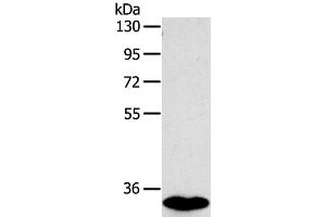 Western Blot analysis of Human fetal intestines tissue using SULT1B1 Polyclonal Antibody at dilution of 1:800 (SULT1B1 Antikörper)